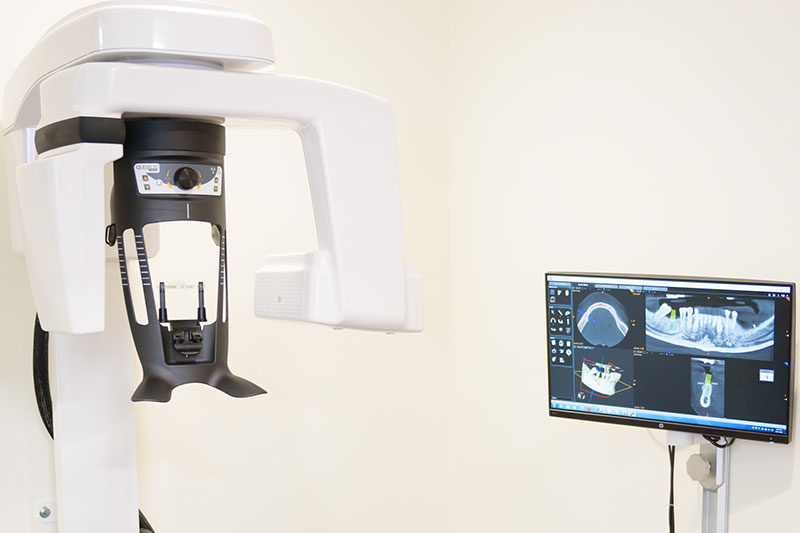 Cone Beam CT Imaging in Torrance